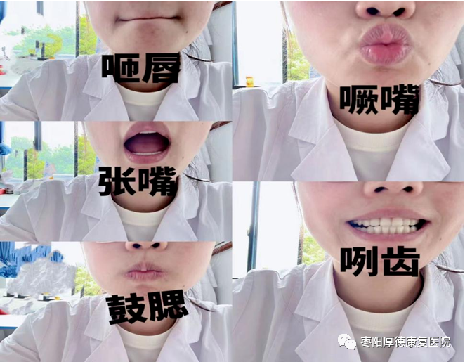 吞咽障碍的治疗