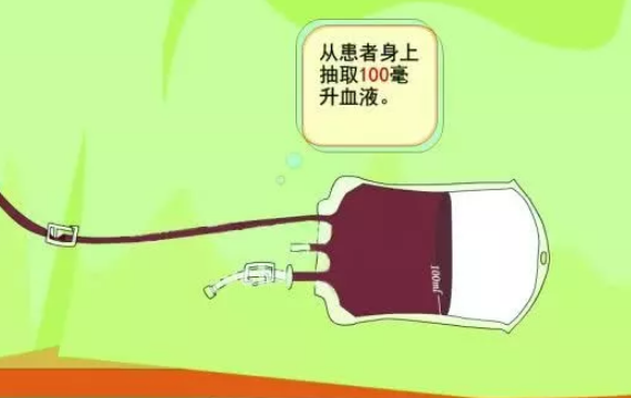 三氧大自血疗法